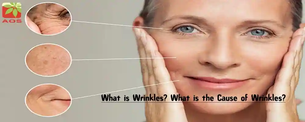 Best Essential Oils for Wrinkles