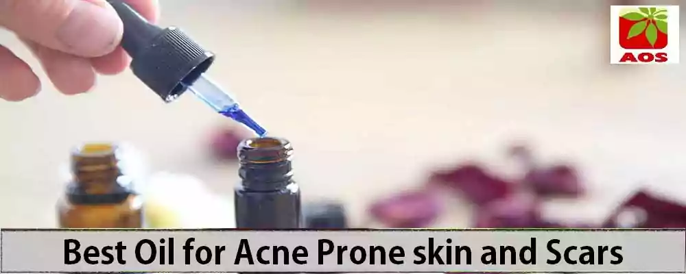 Essential Oils for Acne Scars