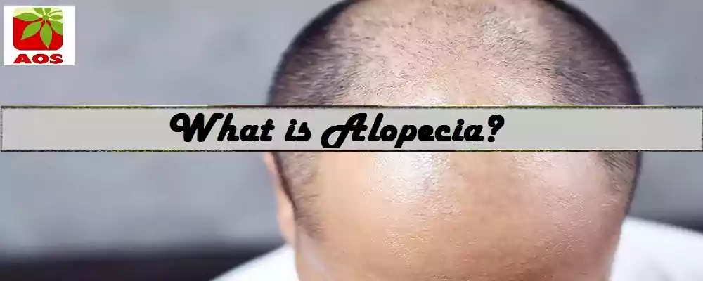 Oils for Alopecia