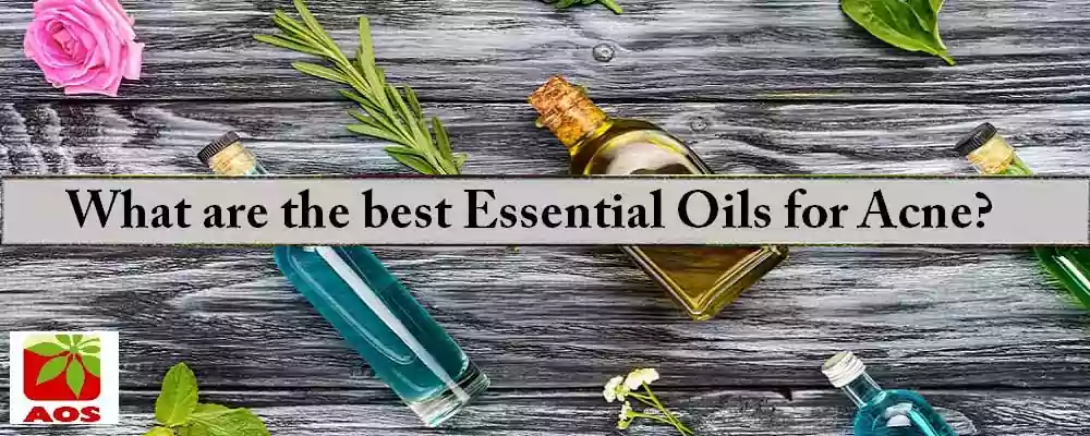 Essential Oils for Acne