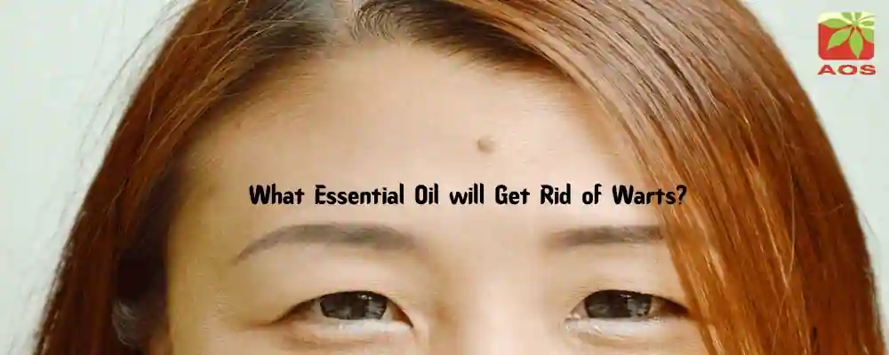 Essential Oils for warts