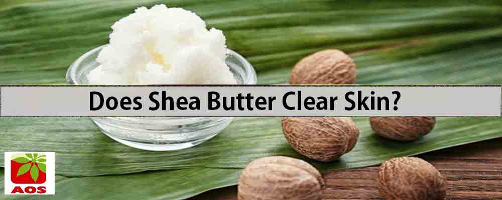 Does Shea Butter Clear Skin ? Health Benefits and Uses