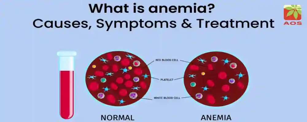 Best Essential Oils for Anemia