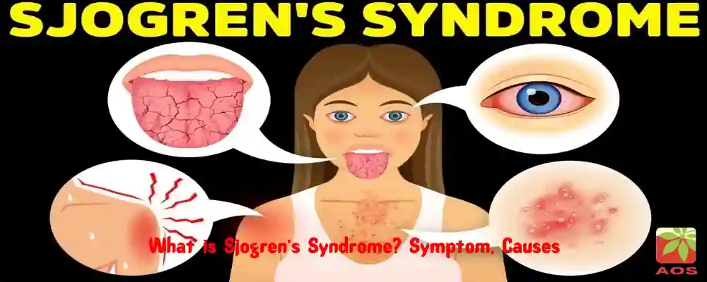Essential Oils for Sjogrens Syndrome
