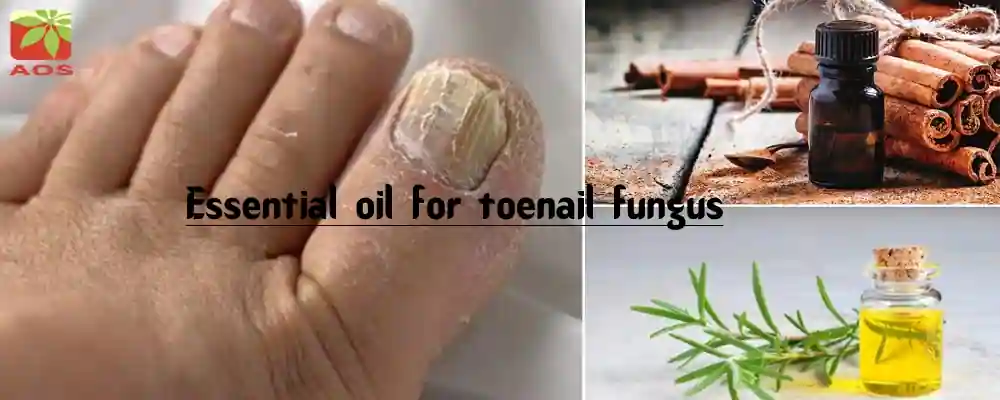 Essential Oil for Toenail Fungus
