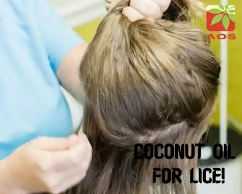 Coconut Oil for Lice