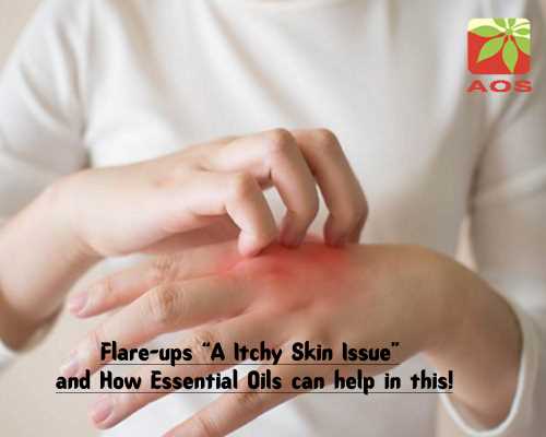 Essential Oils for Flare Ups